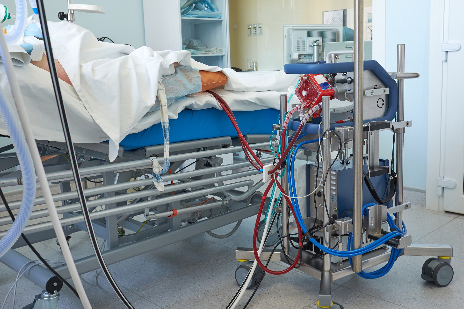 ECLS/ECMO in Deutschland – was die Fallzahlen zeigen und was das für die Materialversorgung bedeutet